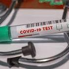FAKE Trattieni il respiro: così scopri se soffri di Covid-19